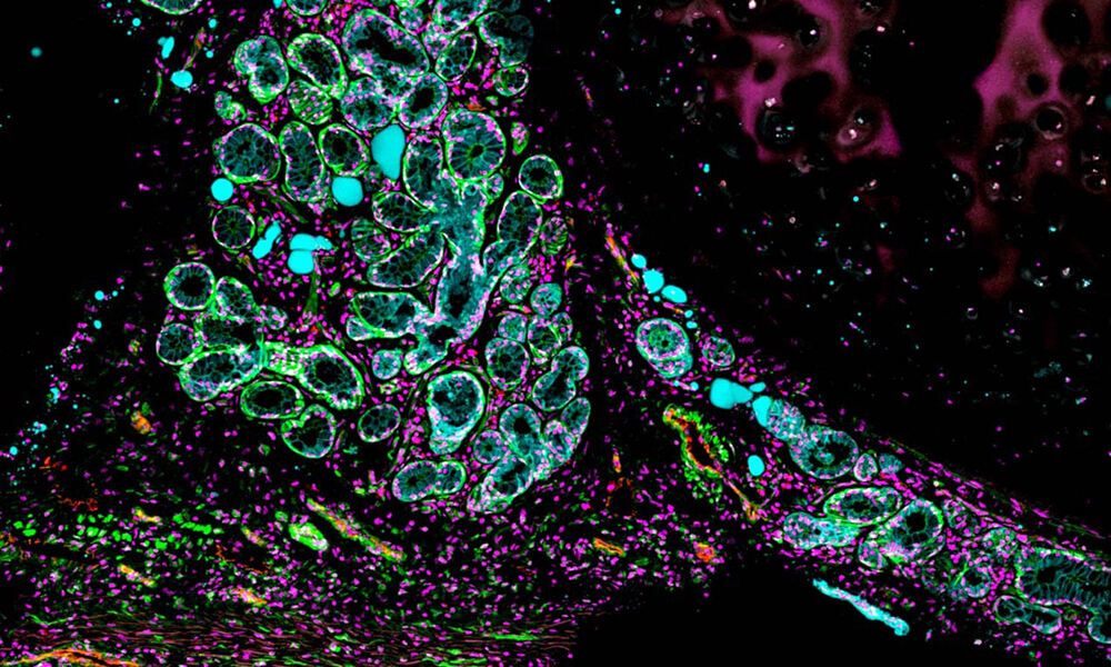 Microscopy images of lung cells