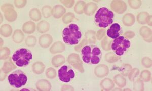 HTLV-1 leukaemic cells. Credit: Blood Journal. doi: 
https://doi.org/10.1182/blood-2009-09-245233
