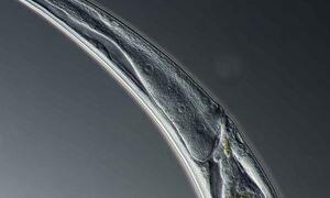 C elegans microscopy. Credit Arturo Agostino. www.microscopeitaly.it
