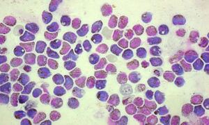 Gametocytes of malaria-causing Plasmodium parasites
