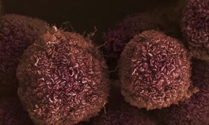 Pancreatic cancer cells: one of 43 types of cancer studied by the Wellcome 
Sanger Institute for gene fusions. Image credit: Anne Weston, Francis Crick 
Institute
