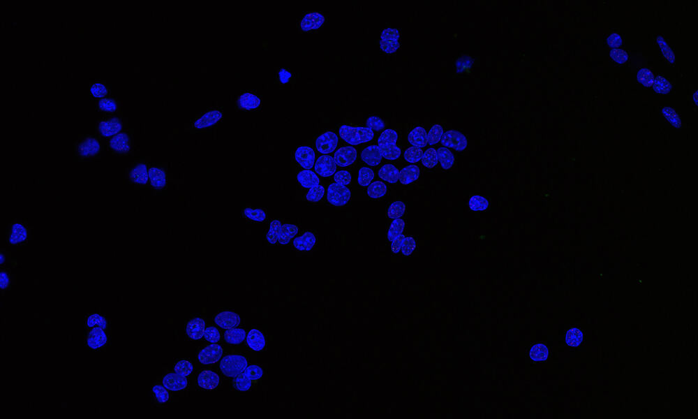 Microscopy image showing mouse cells in blue on a dark background. The mouse cells look like little blue blobs.