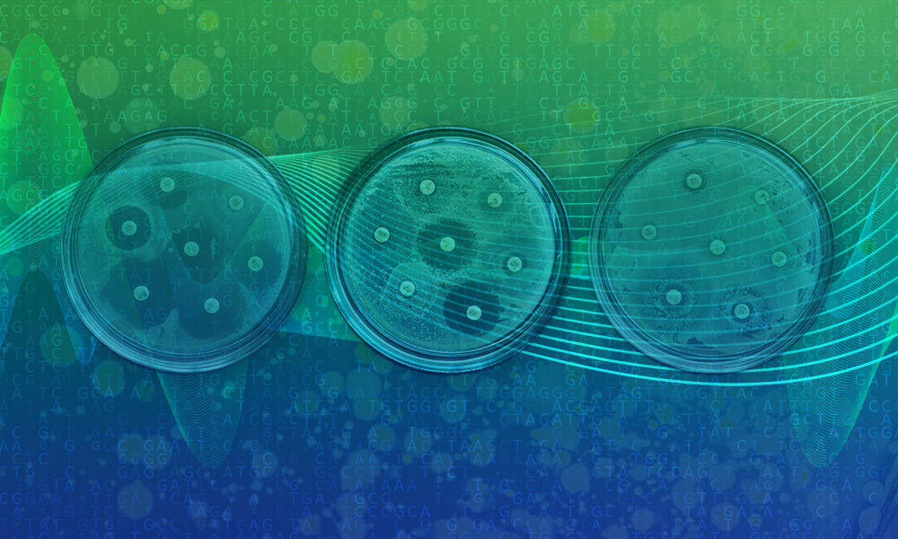 Bacteria growing on plates to show antibiotic resistance