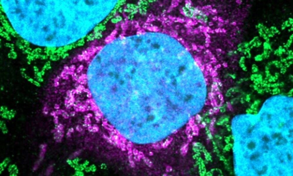 Human and coronavirus protein interaction
