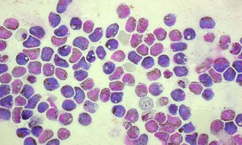 malaria parasite cell