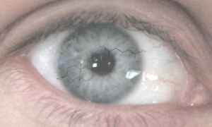Human eye (Wikimedia Commons) with ChEBI structure 16521 - lanosterol
